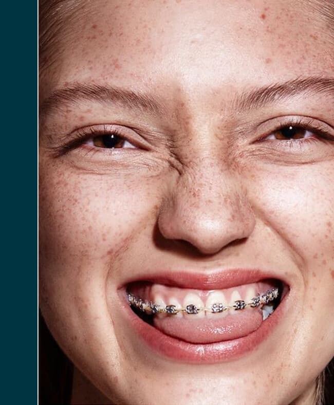 Brackets: Transformando Sonrisas