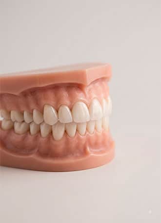 estética dental